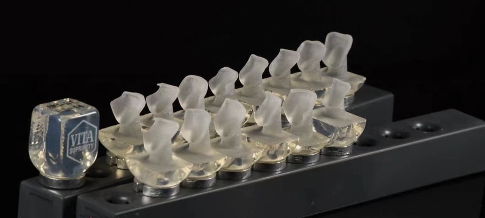 Digital ceramics anterior case example