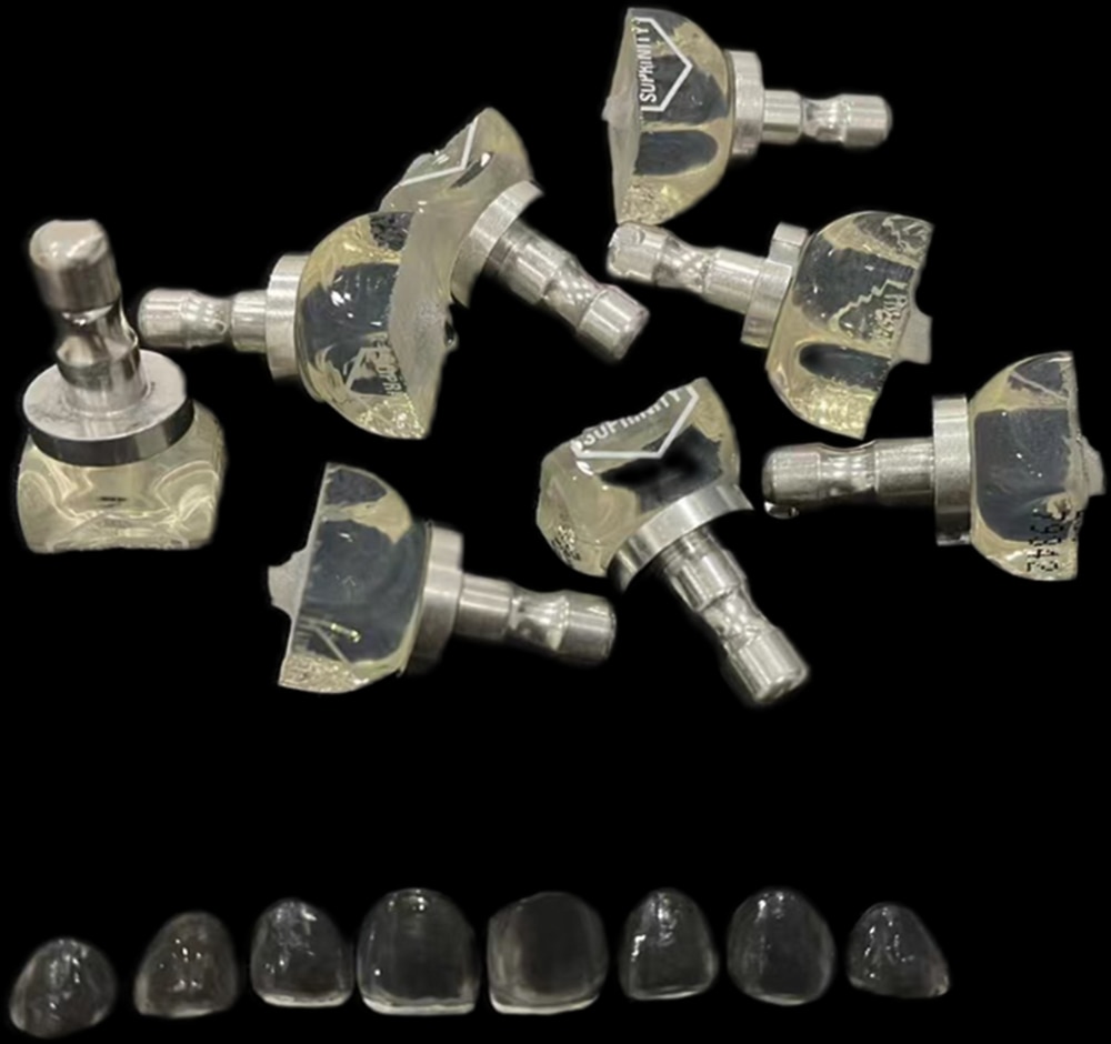 Digital ceramics case series example