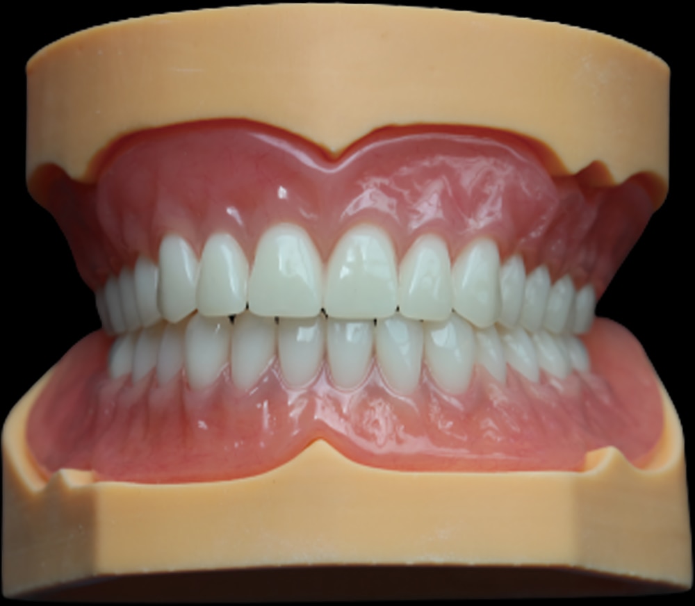 Digital denture setup example