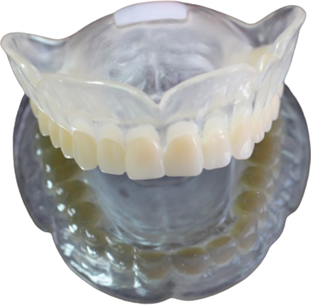 Flexible denture example five