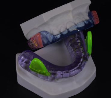 Orthodontics Products example