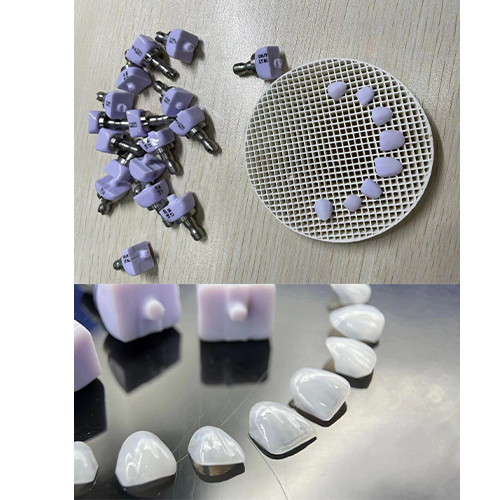 CAD veneer material samples and completed veneers