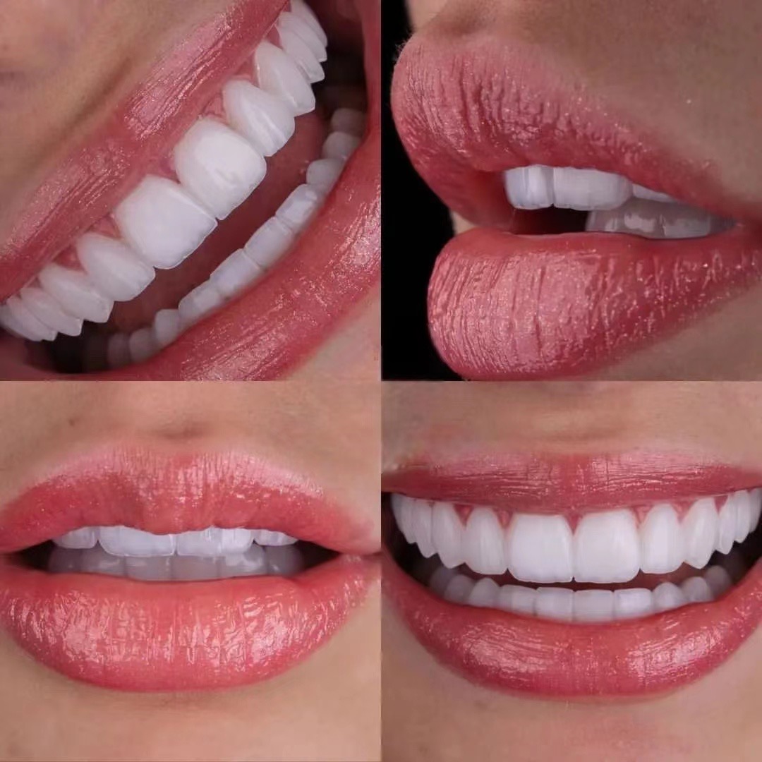 Veneer shade and texture reference