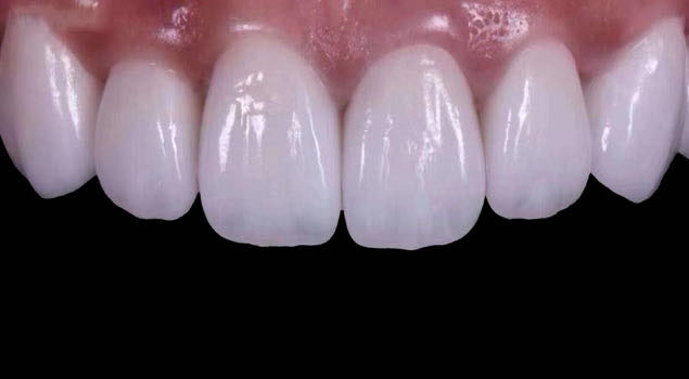 After treatment, case 2