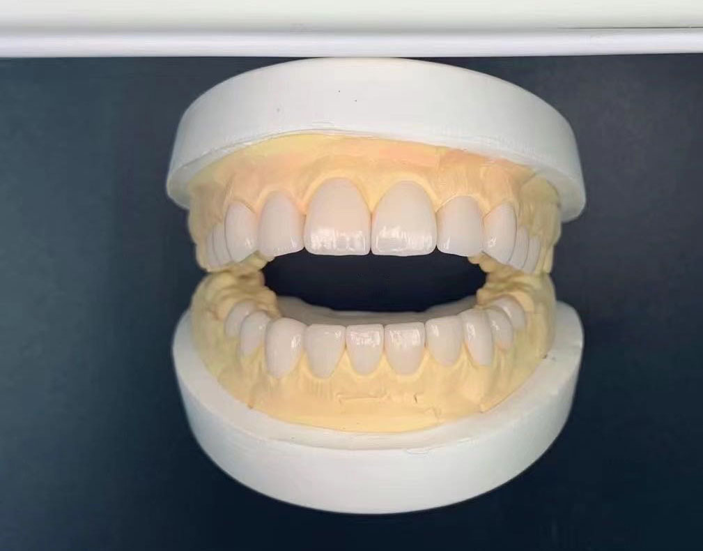 After treatment, case 6