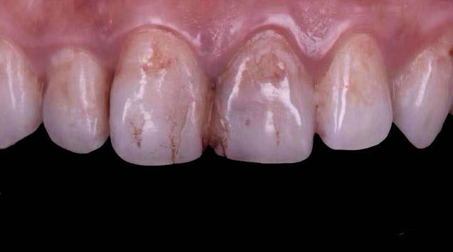 Before treatment, case 2