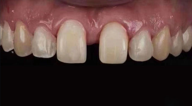Before treatment, case 3