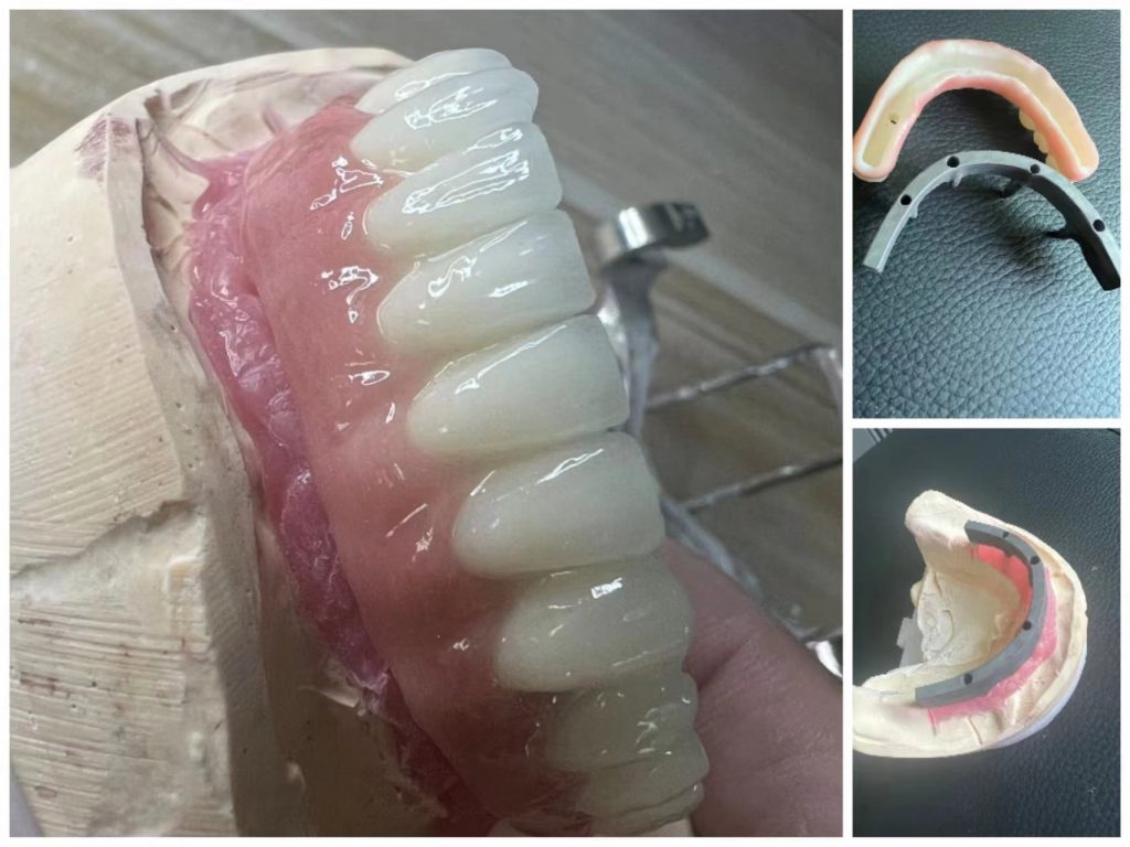Implant Instructions example