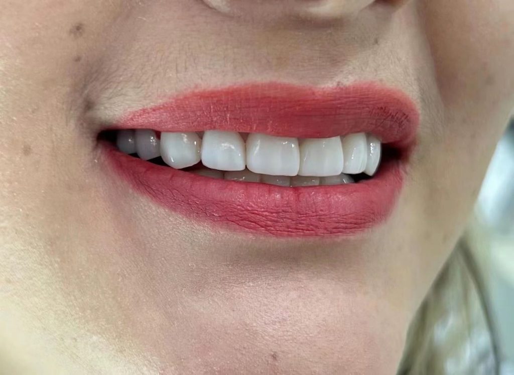 Clinical cases of Prosthodorntics example