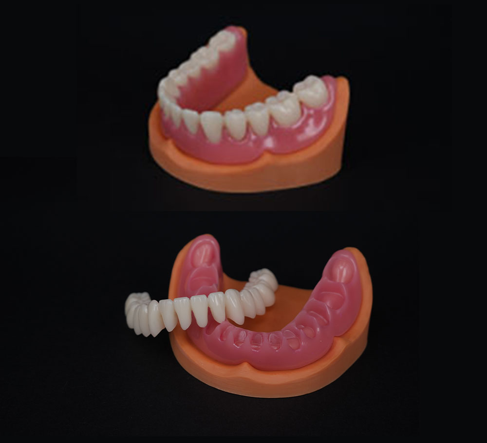 Digital denture try-in example
