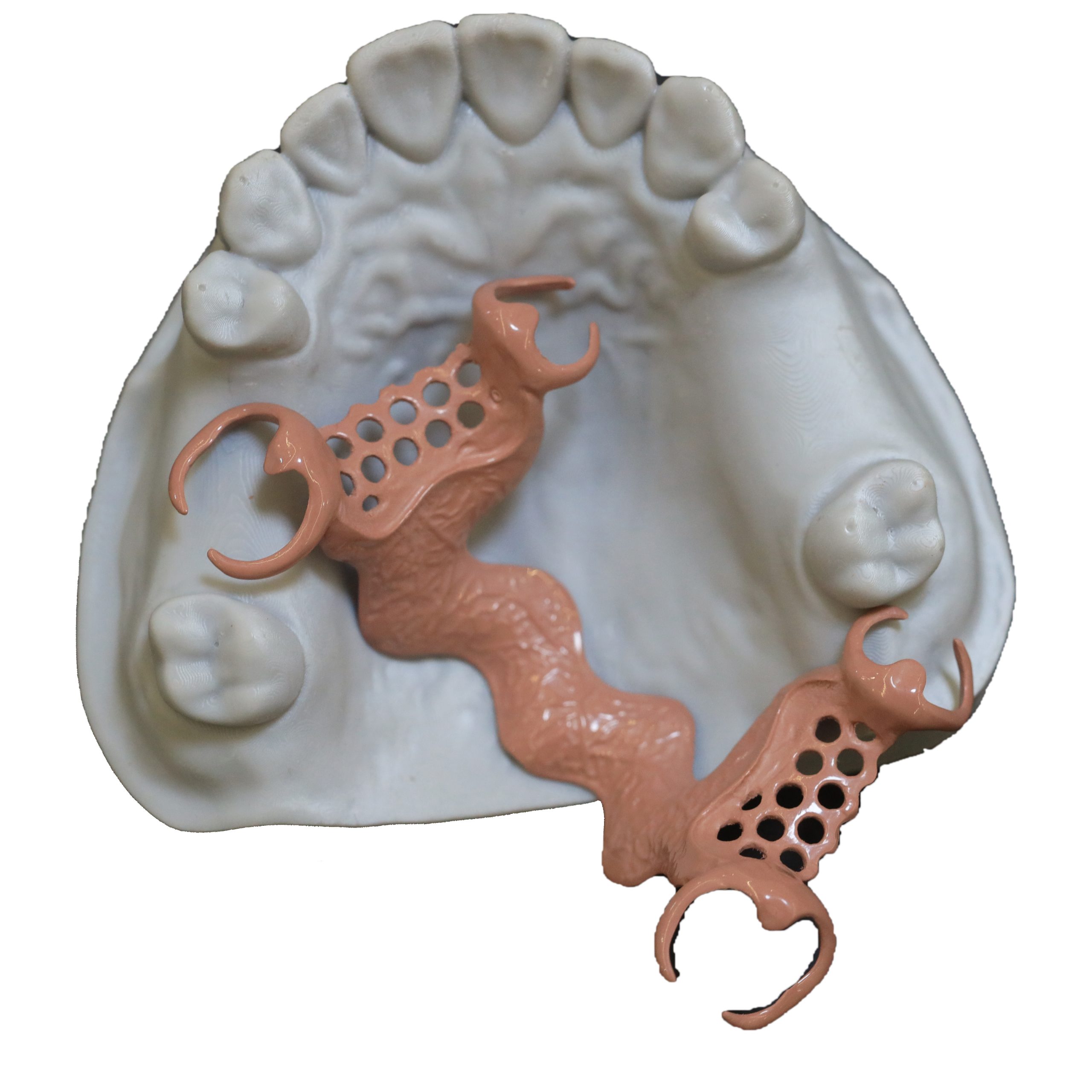 Removable framework example fourteen