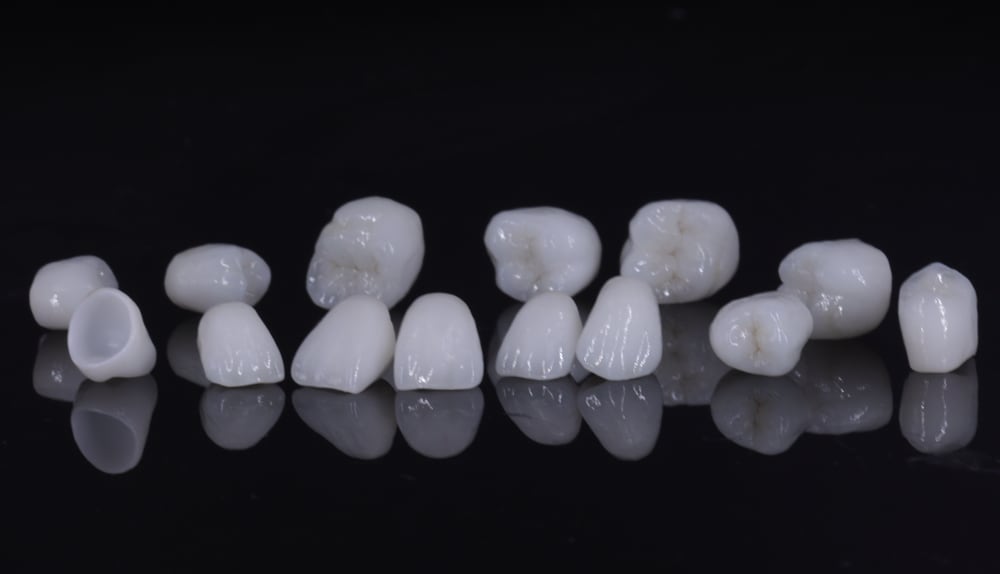 Layered zirconia restorative example