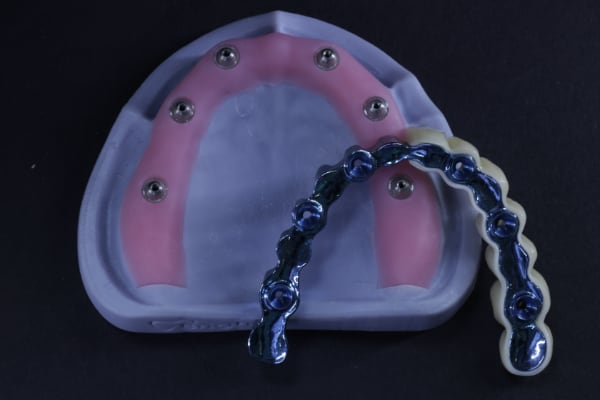 Implant bar restorative surface example