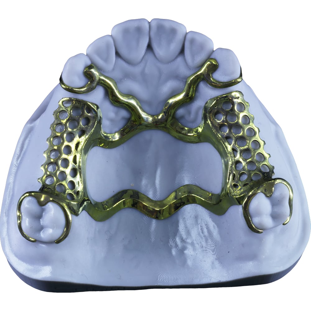 Removable framework example eight