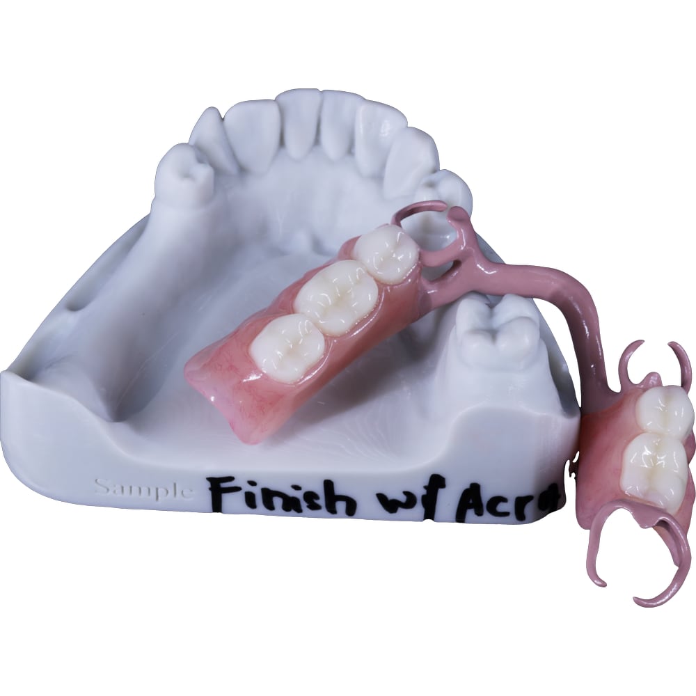Removable framework example five