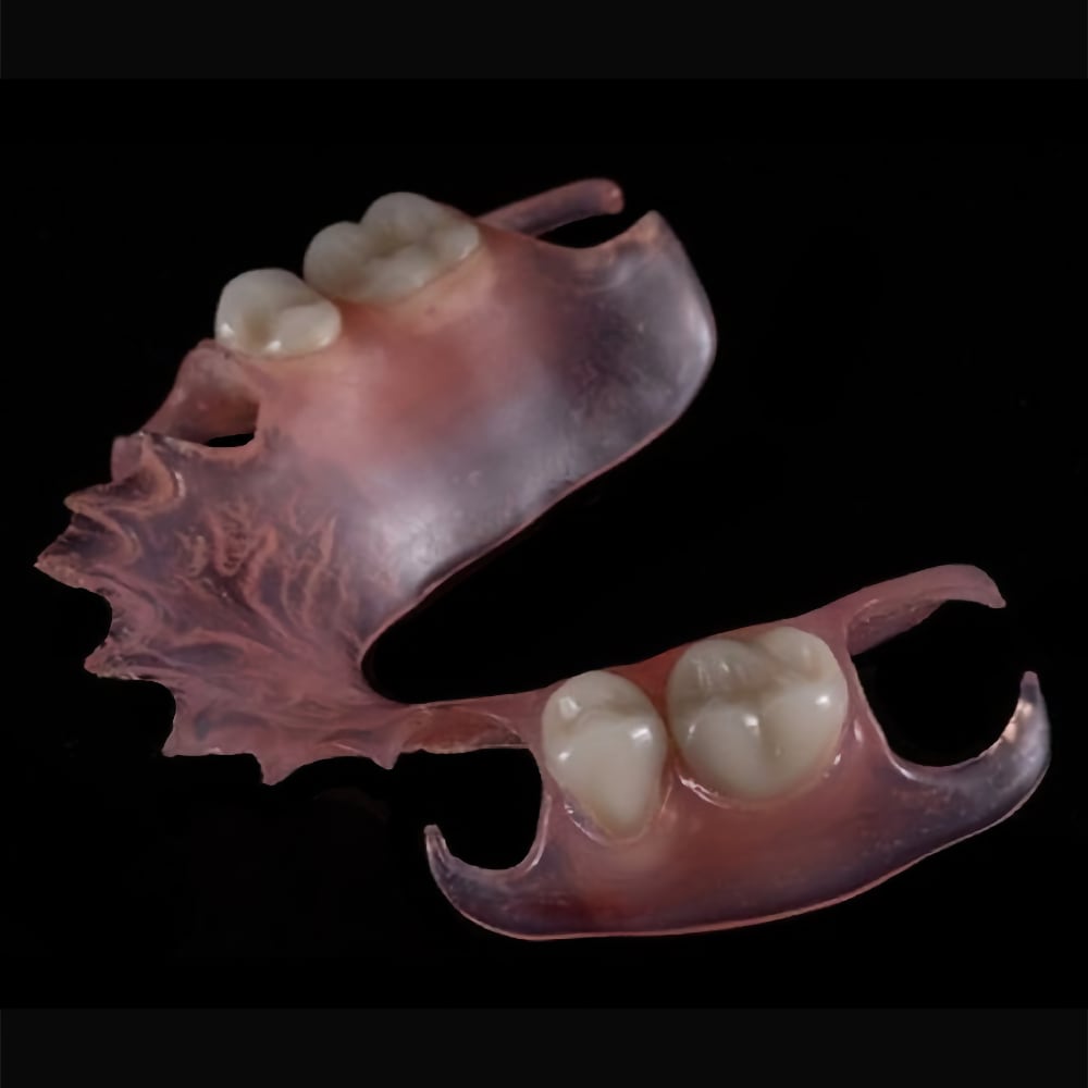 Flexible denture example six
