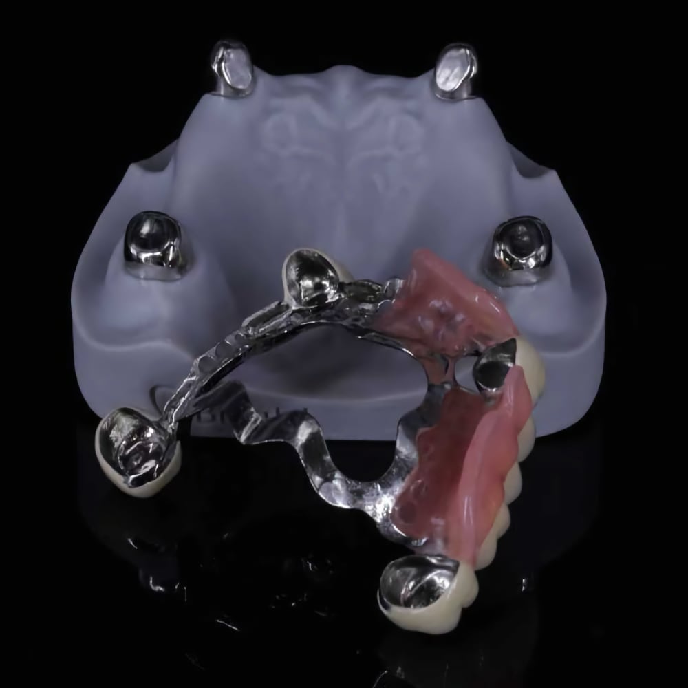 Flexible denture example seven