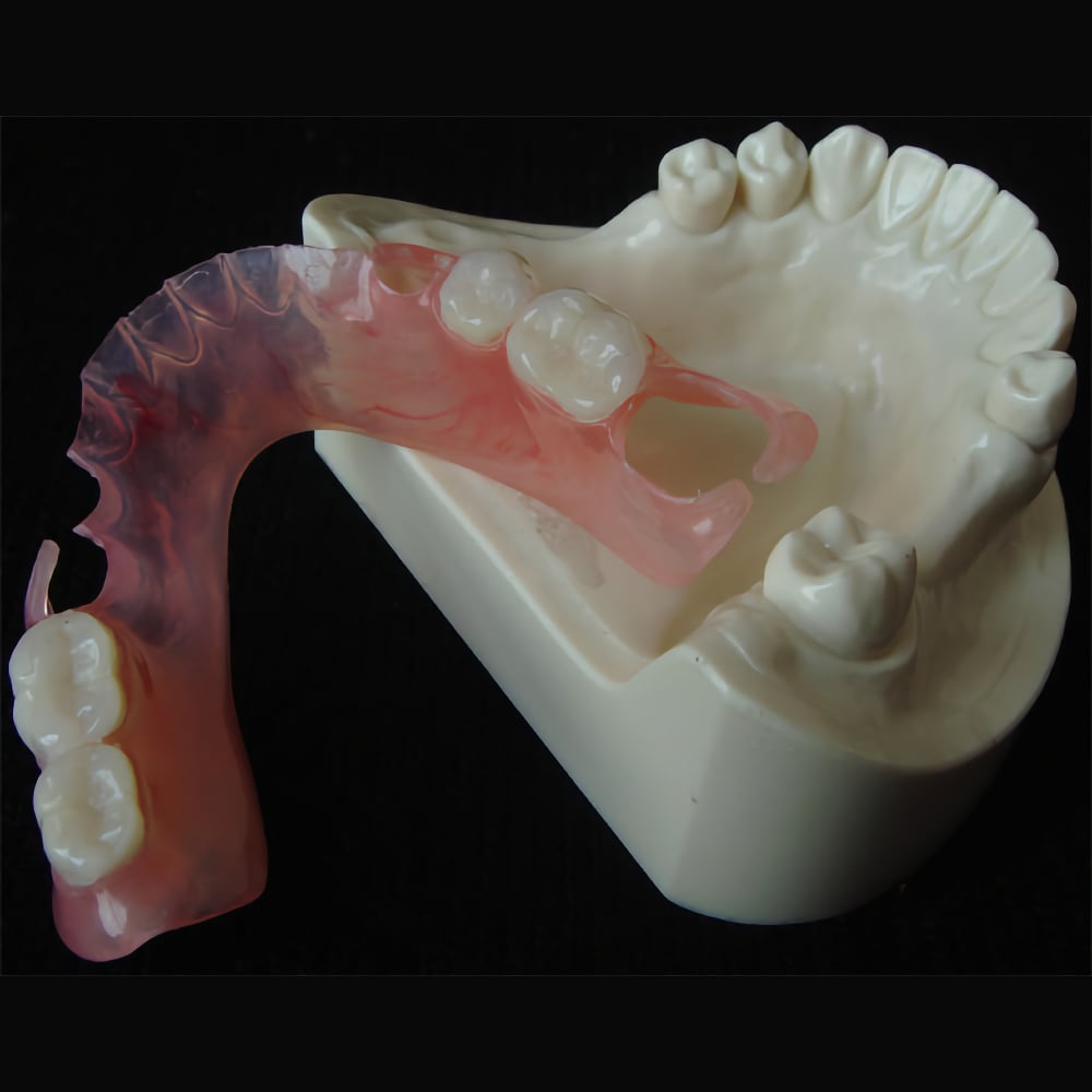 Flexible denture example one