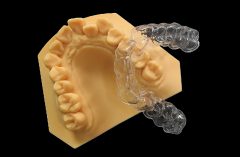 Clear Aligners