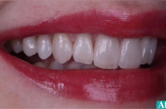 Clinical Cases of Prosthodontics