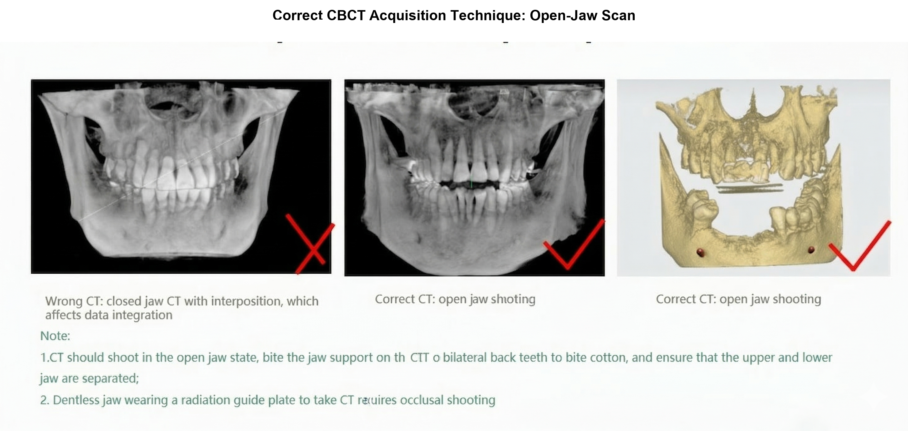 Correct CBCT acquisition technique open-jaw scan reference