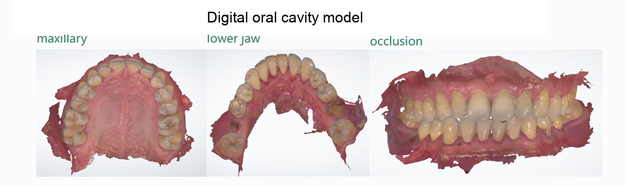 Intraoral model data requirements upper scan reference