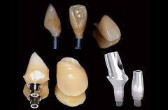 Implant Products