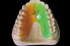 Orthodontics Products