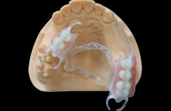 Removables Denture