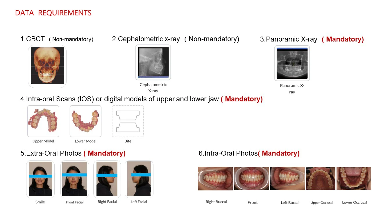 Clear Aligners