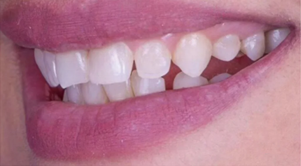 Clinical Cases of Prosthodontics