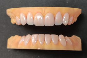 Before treatment, case 5