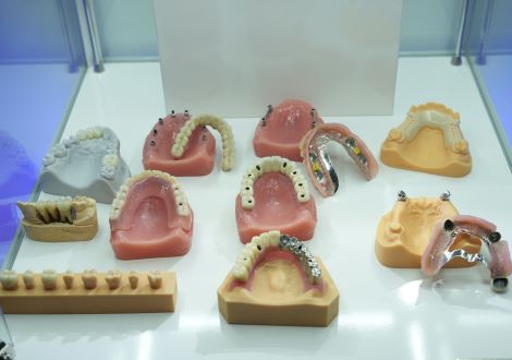 Removable dental appliance samples in a display case