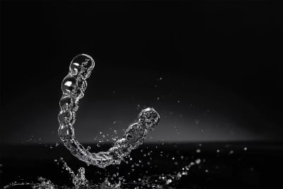 Clear aligner case example two