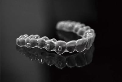 Clear aligner case example three