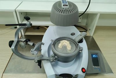 Clear aligner case example five