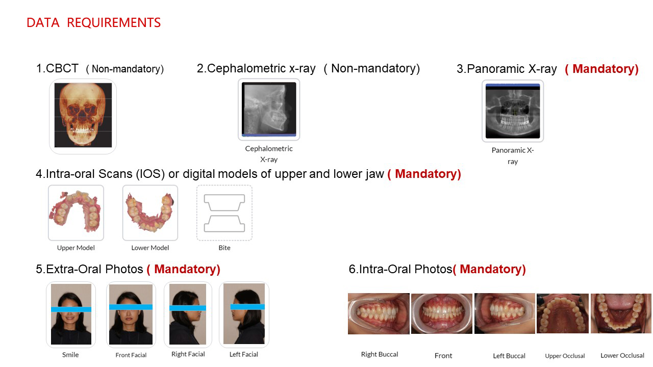 Clear aligner data requirements overview