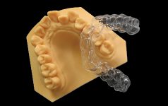 Clear Aligners