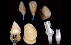 Implant Products