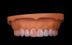NEW CAD VENEERS