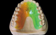 Orthodontics Products