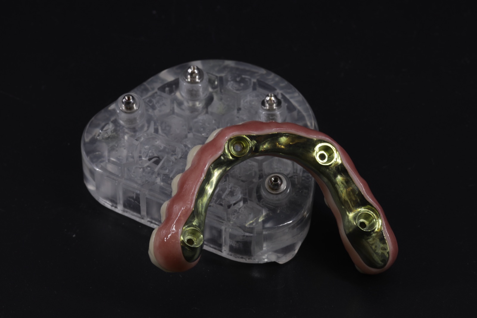 Gold implant bar on clear model with four abutments