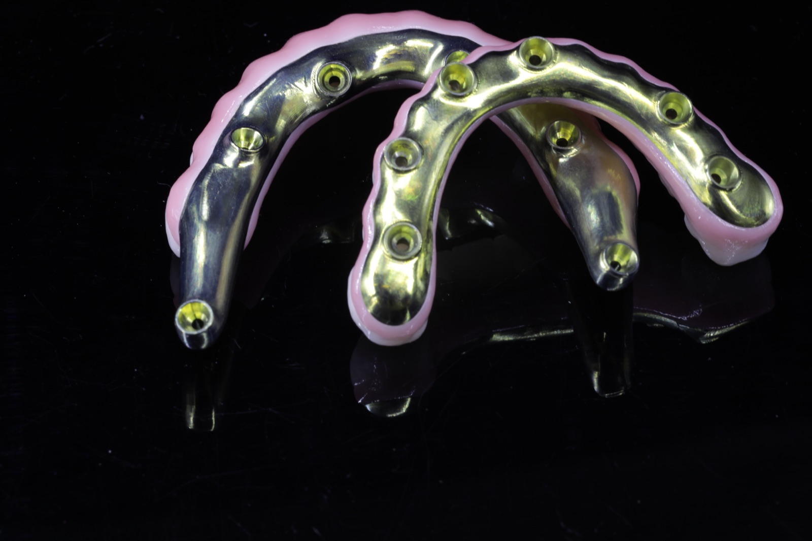 Full gold crown restoration example