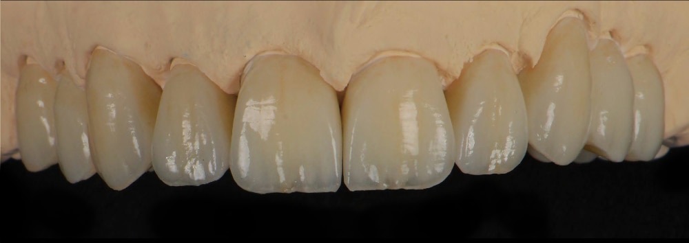 Reference image