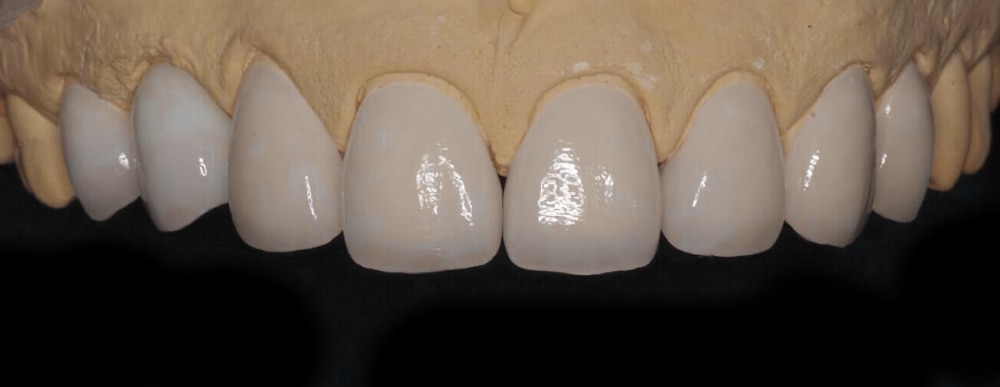 Reference image