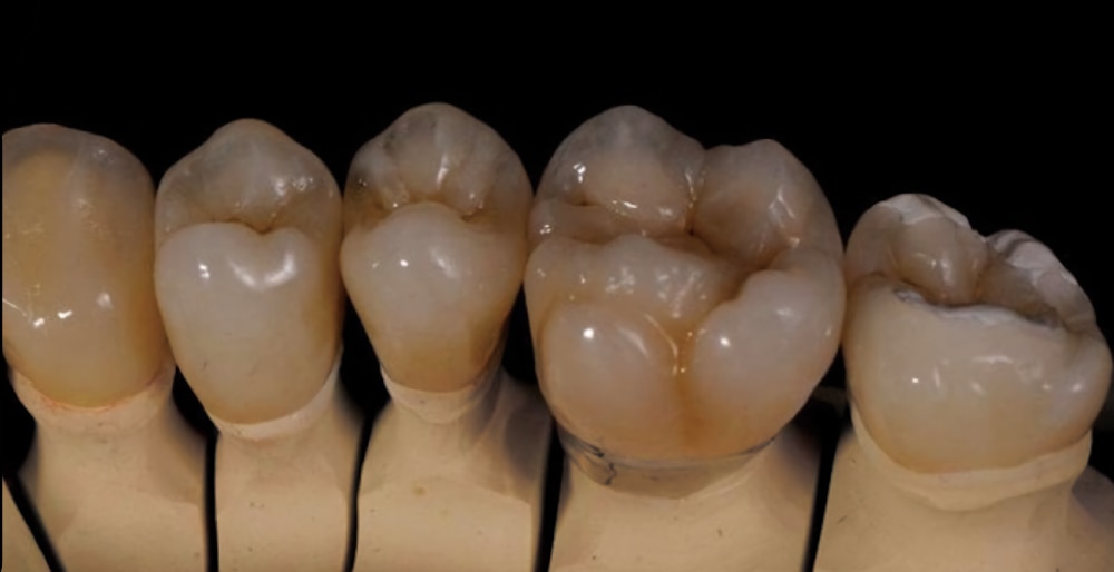 Reference image