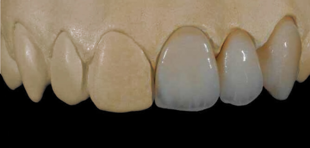 Reference image